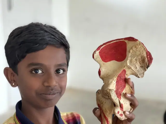 A boy stands beside a large anatomical hip and femur teaching model in an open school corridor